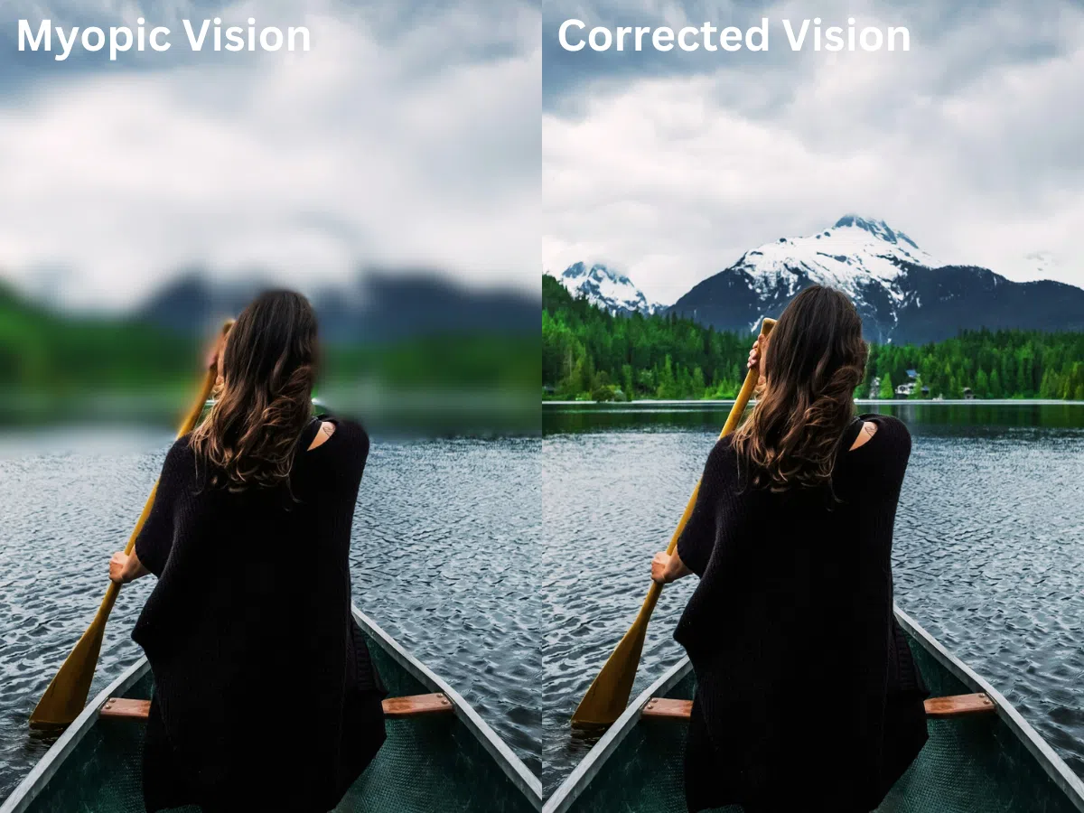 Myopia Vision Comparison - Clear vs Blurry