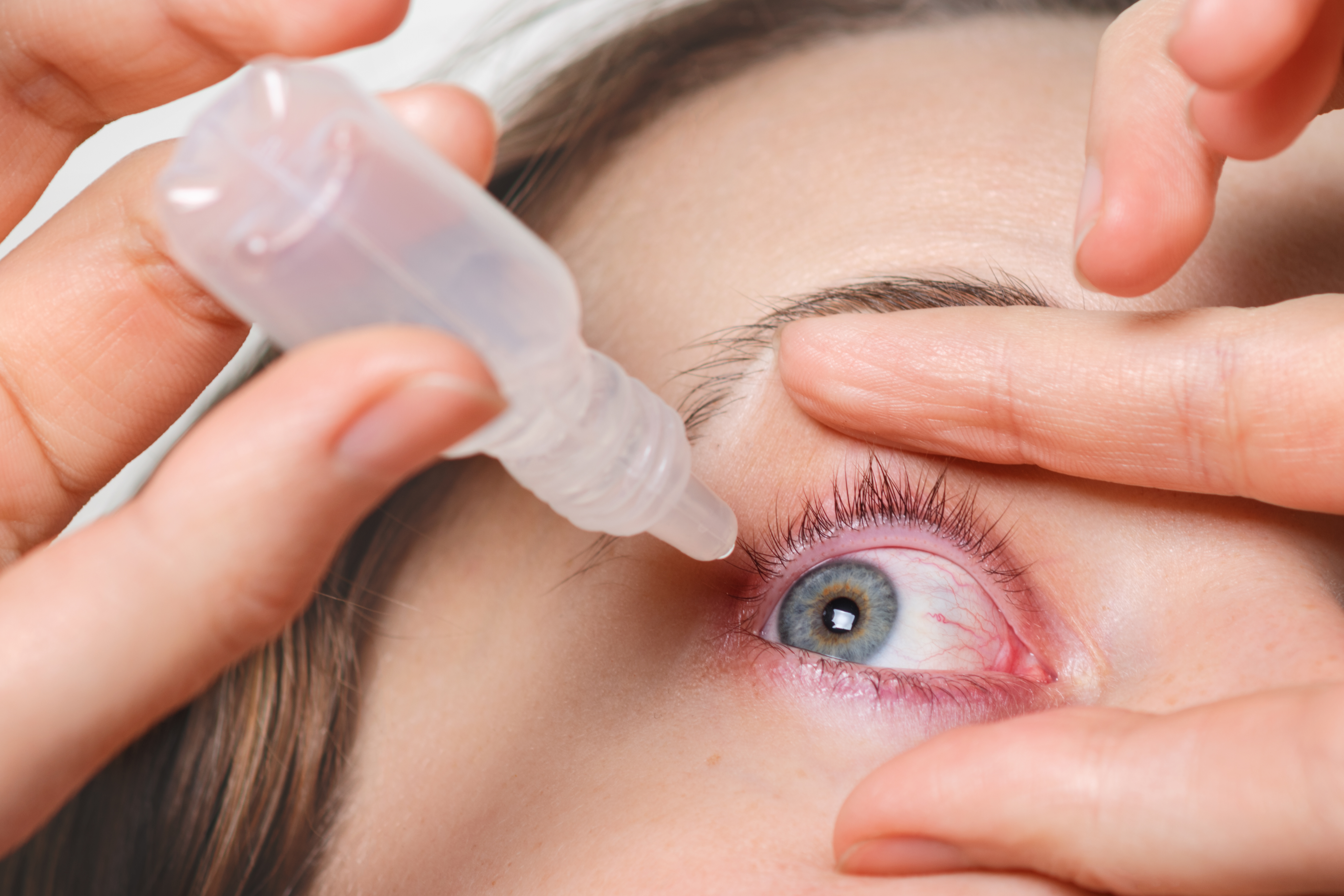 Person applying eye drops for dry eye relief